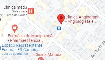 mapa angiograph